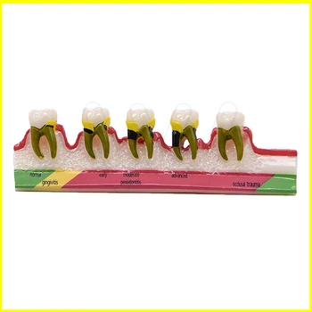 Dantų Ėduonies Demonstravimo Modelis Dantų Mokymo Periodonto Ligų Assort Dantų Typodont Modelis